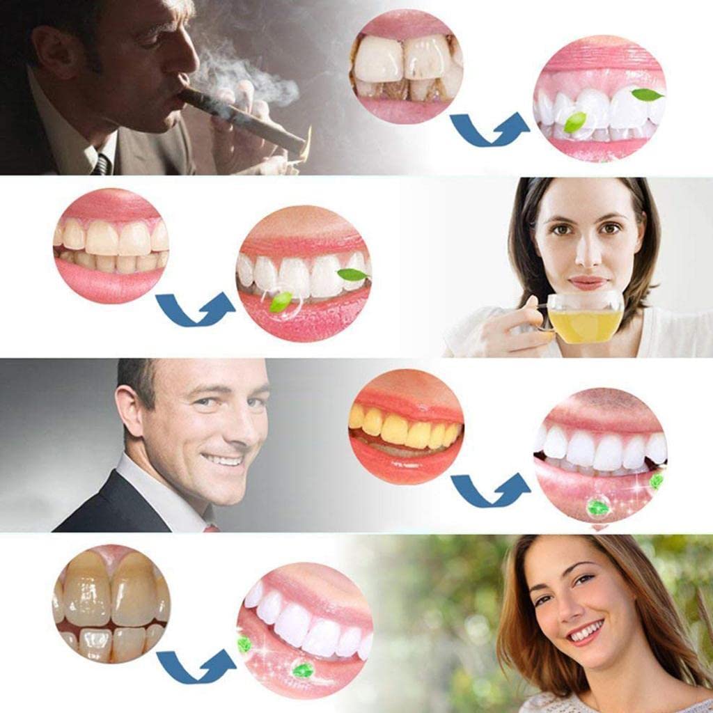 Teeth whitening strips